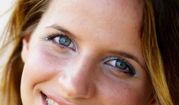 Σιδεράκια για ενήλικες: Ερωτήσεις και απαντήσεις