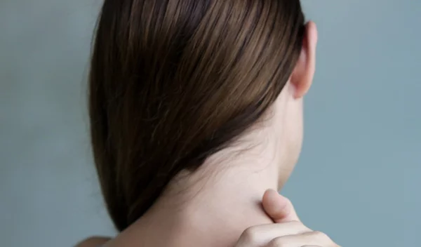 6 facts για την ψωρίαση από τη δερματολόγο