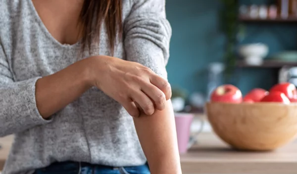 4 tips για ένα υγιέστερο ανοσοποιητικό σύστημα αν έχεις ψωρίαση