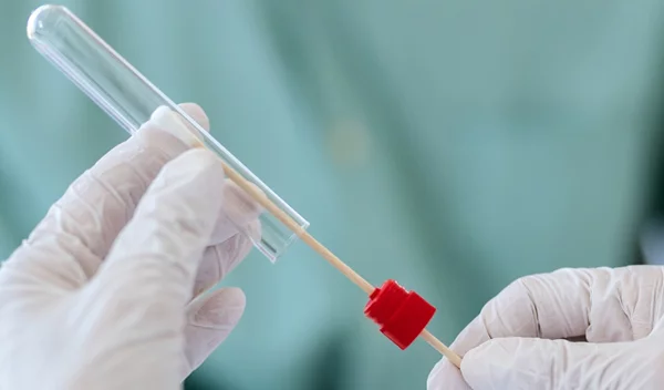 Μοριακό τεστ για κορονοϊό: Πιο πιθανό να βγει θετικό αν το κάνεις μετά το μεσημέρι!