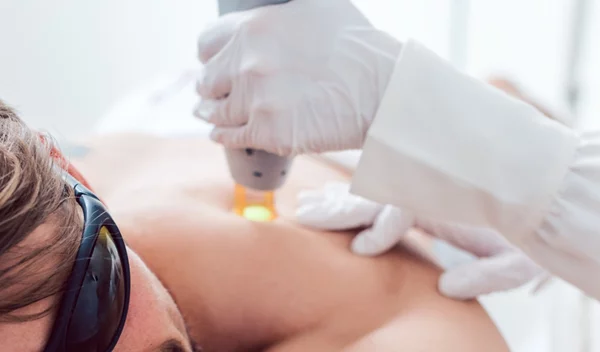 Τρεις λόγοι που οι άνδρες προτιμούν την αποτρίχωση με laser