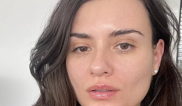 ePatch: Δοκίμασα τη θεραπεία που λειαίνει λεπτές γραμμές και ρυτίδες φυσικά, χωρίς νυστέρι