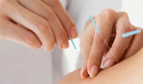 Μπορεί ο βελονισμός να βοηθήσει στην κατάθλιψη;