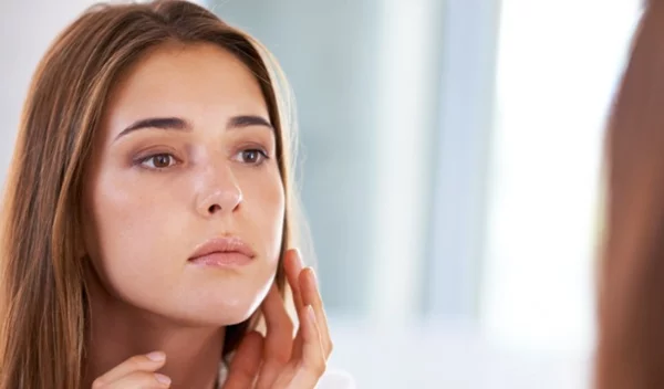 Γιατί έχεις ακόμα ακμή και τι πρέπει να προσέξεις για να τη μειώσεις;