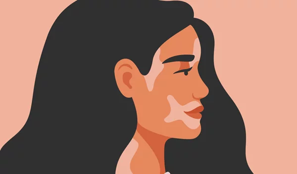 "Δεν είμαι το αυτοάνοσό μου"