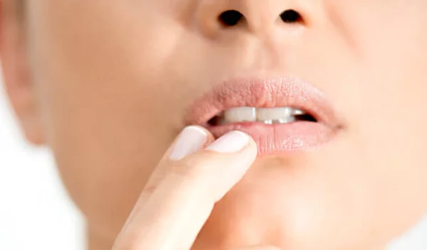 Επιχείλιος έρπης: Τα αίτια, η θεραπεία και η αντιμετώπιση του ιού