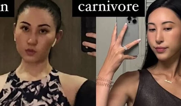 Δεν έφαγε υδατάνθρακες για έξι χρόνια και τα αμφιλεγόμενα αποτελέσματα έγιναν viral - η ιστορία μιας 28χρονης (πρώην vegan!)