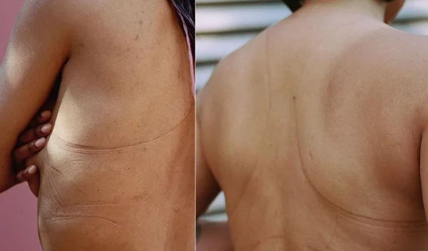 Η νέα καμπάνια της Adidas είναι μια ωδή στο γυναικείο στήθος