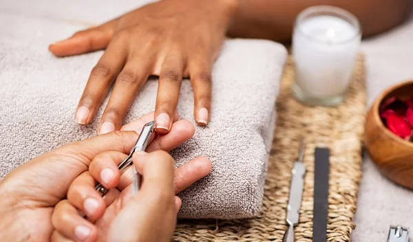 Κάνει να κόβουμε τα πετσάκια μας;