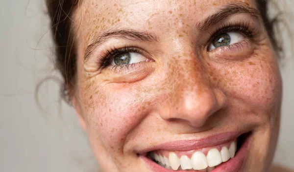 Smile lines: Το έξυπνο hack για να βελτιώσεις την όψη των ρυτίδων γύρω από το στόμα