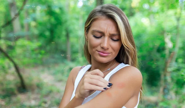 Είσαι "γλυκοαίματη"; Δοκίμασε αυτό για να απωθήσεις τα κουνούπια