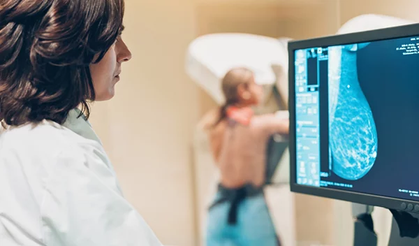 Καρκίνος του μαστού: Νέες κατευθυντήριες οδηγίες για την πρώτη μαστογραφία