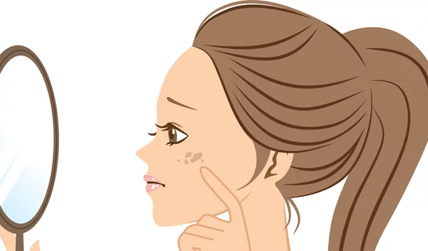 Υπερμελάγχρωση: Τα SOS της αντιμετώπισης των καφέ κηλίδων στο δέρμα