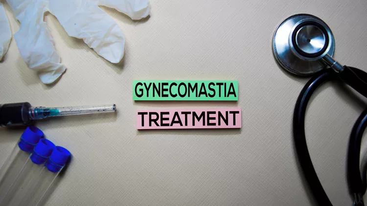 gynecomastia