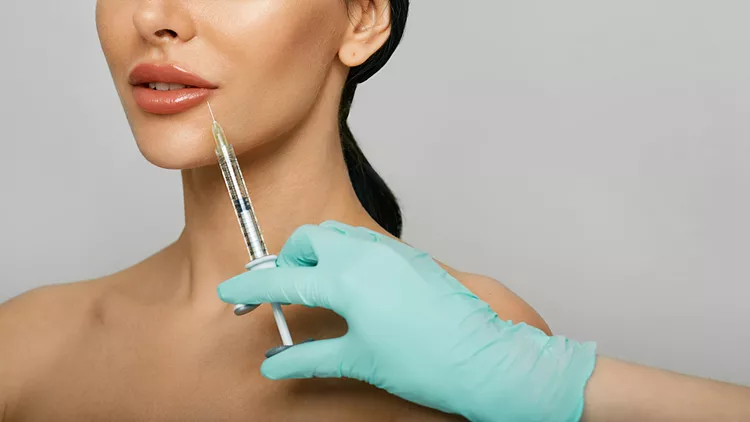 Fillers χειλιών