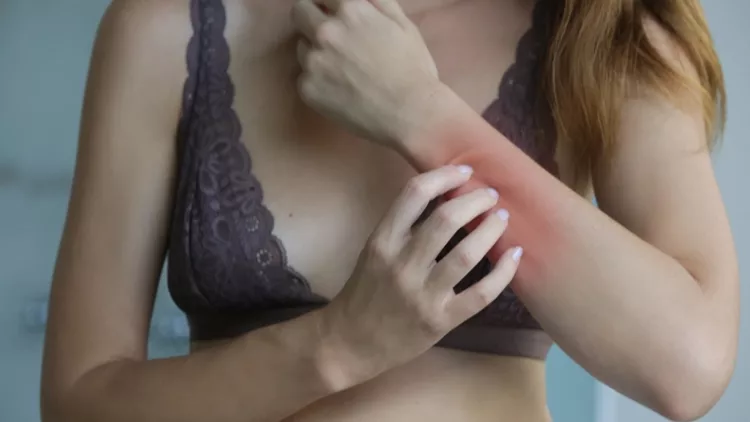 Γυναίκα που ξύνεται - αλλεργίες στο δέρμα