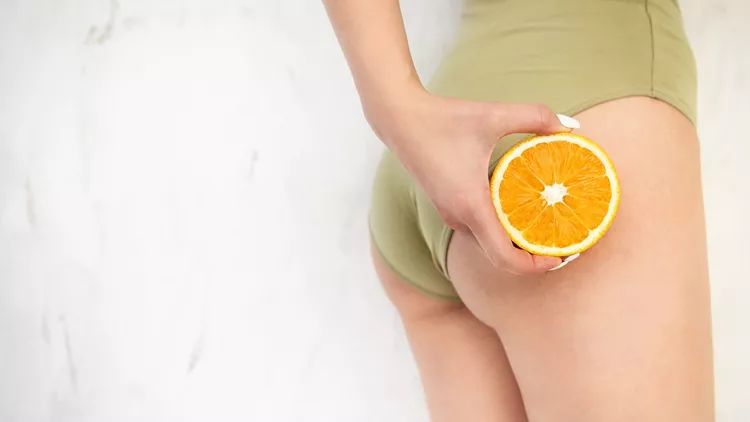 cellulite