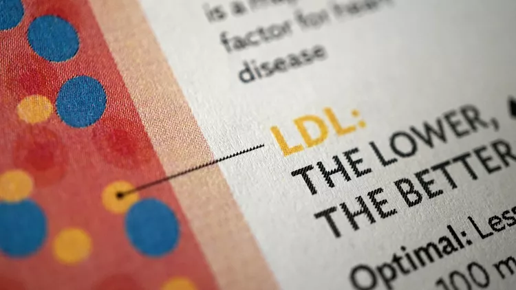 cholesterol