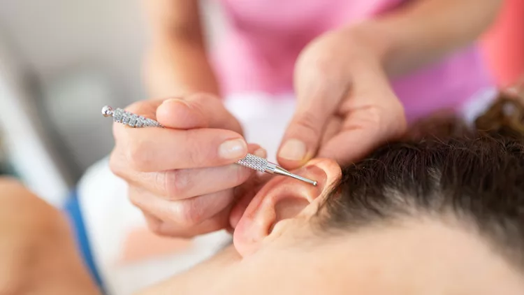 auriculotherapy
