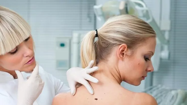 eksetasi-derma