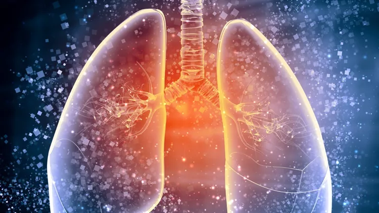 πνεύμονες καρκίνος του πνεύμονα