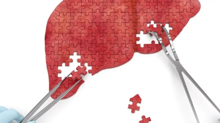 συκώτι ήπαρ ηπατίτιδα