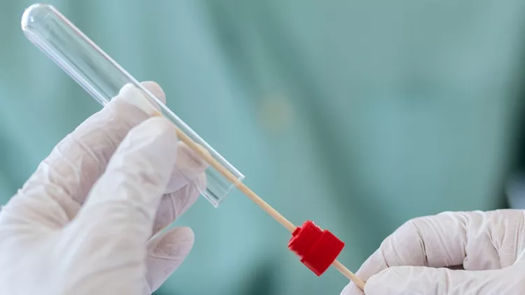 closeup-of-doctor-doing-pcr-test-during-covid19-pandemic-picture-id1277147183