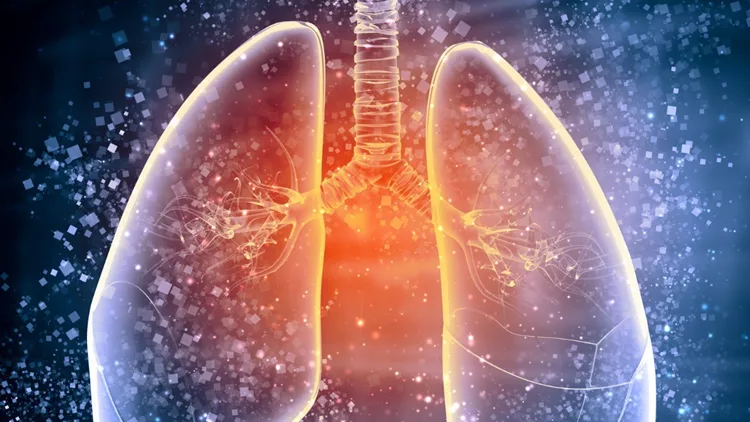 πνεύμονες καρκίνος του πνεύμονα